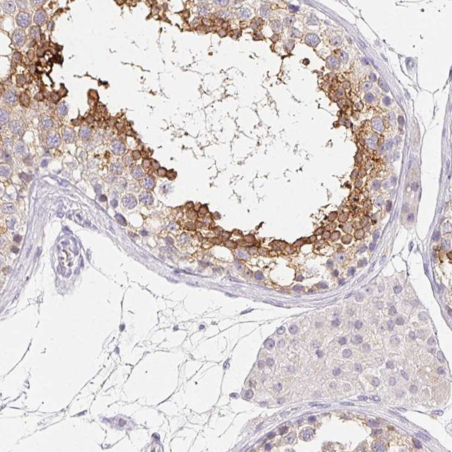 GLIPR1L1 Antibody in Immunohistochemistry (Paraffin) (IHC (P))