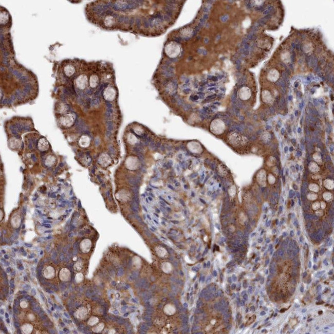 C19orf61 Antibody in Immunohistochemistry (Paraffin) (IHC (P))
