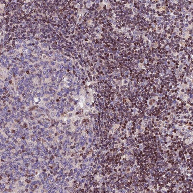 RINL Antibody in Immunohistochemistry (IHC)