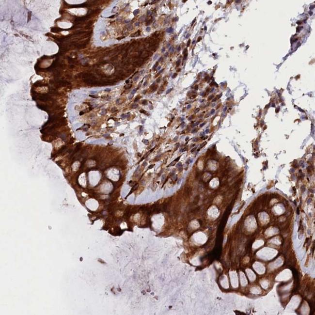 ARRDC4 Antibody in Immunohistochemistry (Paraffin) (IHC (P))