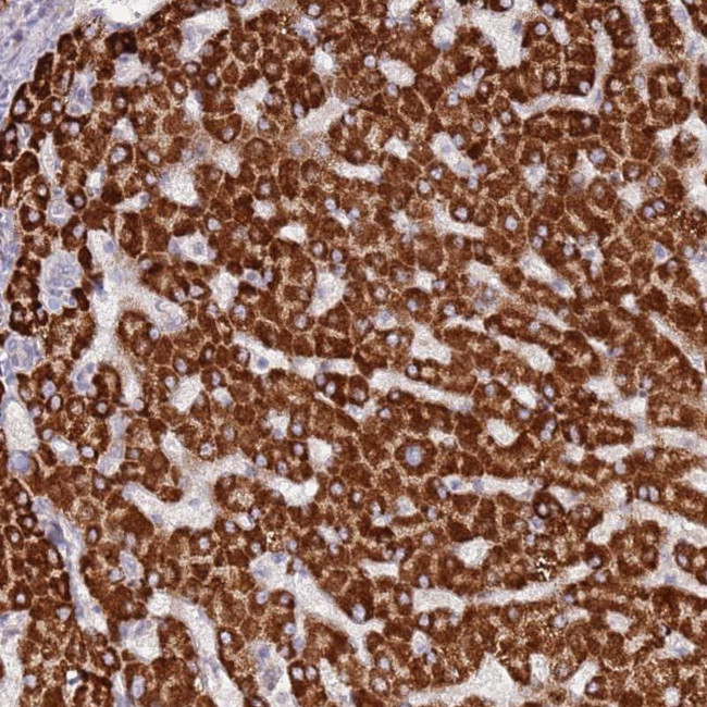 LGI4 Antibody in Immunohistochemistry (Paraffin) (IHC (P))
