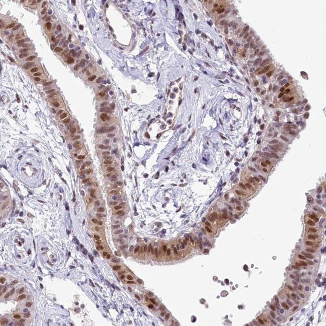 MRPL54 Antibody in Immunohistochemistry (IHC)