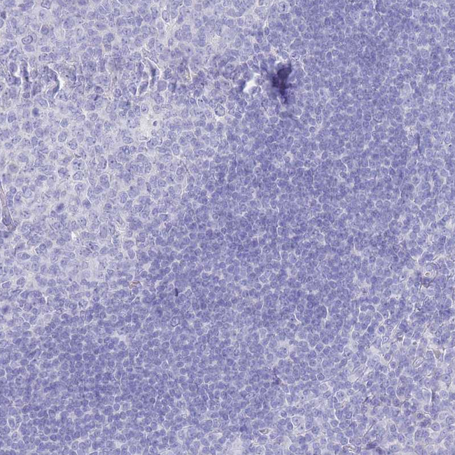 LRRC37A Antibody in Immunohistochemistry (Paraffin) (IHC (P))