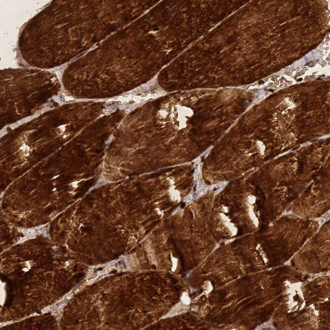 ZNF417 Antibody in Immunohistochemistry (Paraffin) (IHC (P))