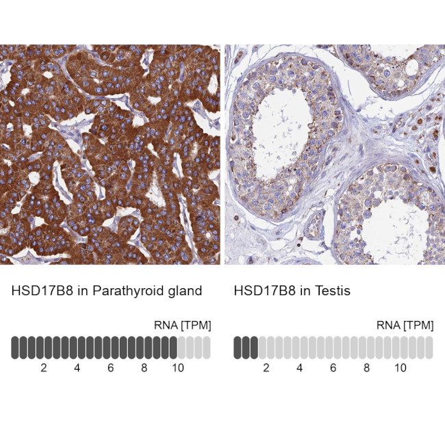 HSD17B8 Antibody in Immunohistochemistry (IHC)