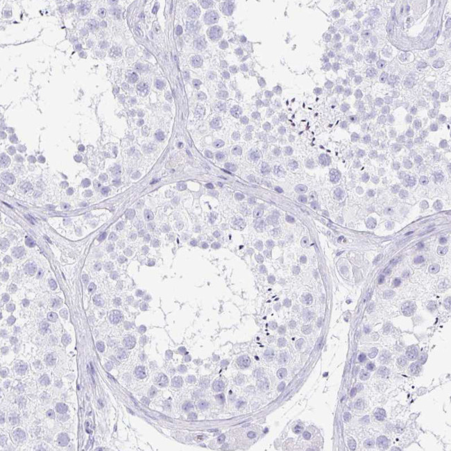 PRR4 Antibody in Immunohistochemistry (Paraffin) (IHC (P))