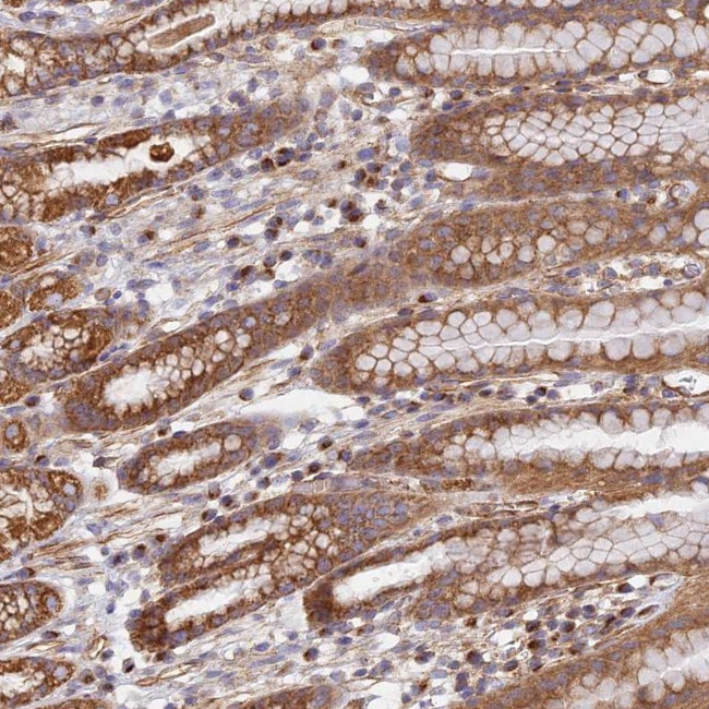 DDA1 Antibody in Immunohistochemistry (Paraffin) (IHC (P))