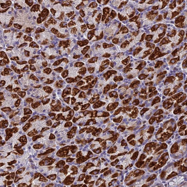 ZNF563 Antibody in Immunohistochemistry (Paraffin) (IHC (P))
