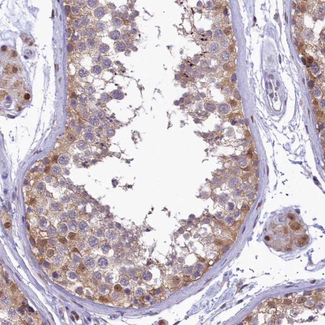 IZUMO2 Antibody in Immunohistochemistry (Paraffin) (IHC (P))