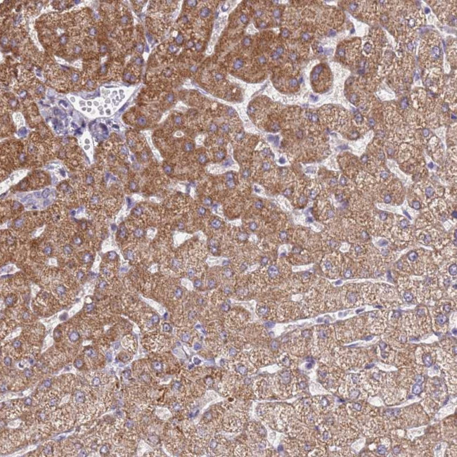 ORNT1 Antibody in Immunohistochemistry (Paraffin) (IHC (P))