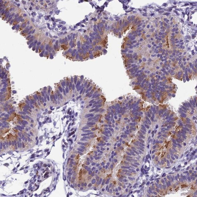 IFT140 Antibody in Immunohistochemistry (IHC)