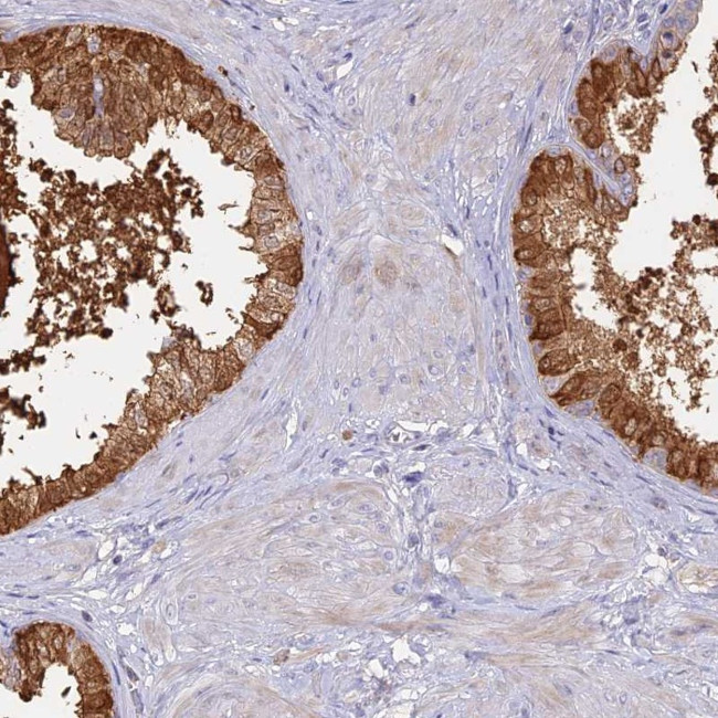 SFT2D2 Antibody in Immunohistochemistry (Paraffin) (IHC (P))