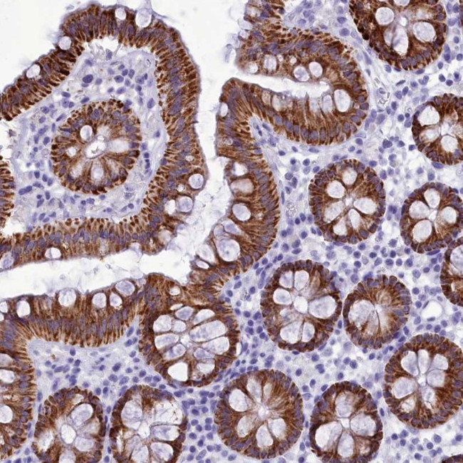 BRI3 Antibody in Immunohistochemistry (Paraffin) (IHC (P))