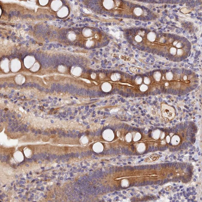MISP3 Antibody in Immunohistochemistry (Paraffin) (IHC (P))
