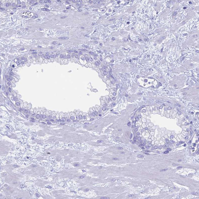 RP1 Antibody in Immunohistochemistry (Paraffin) (IHC (P))