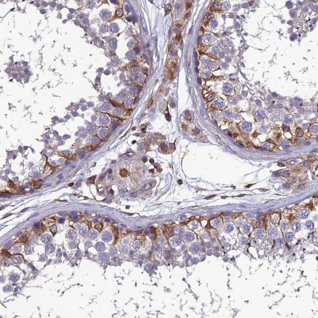 PSMD11 Antibody in Immunohistochemistry (IHC)
