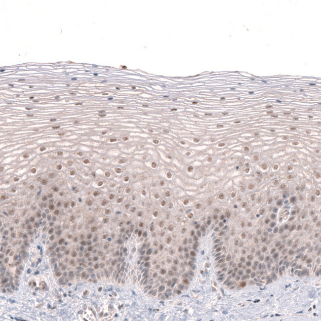 MGA Antibody in Immunohistochemistry (IHC)