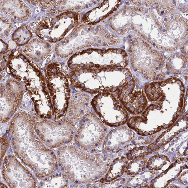 IL20RA Antibody in Immunohistochemistry (Paraffin) (IHC (P))