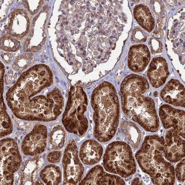 SHISA5 Antibody in Immunohistochemistry (Paraffin) (IHC (P))