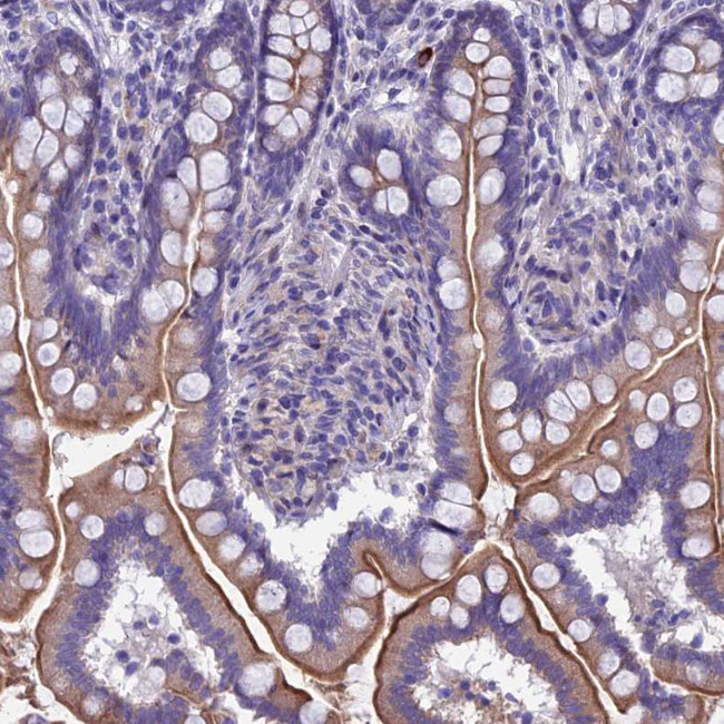TMEM171 Antibody in Immunohistochemistry (Paraffin) (IHC (P))