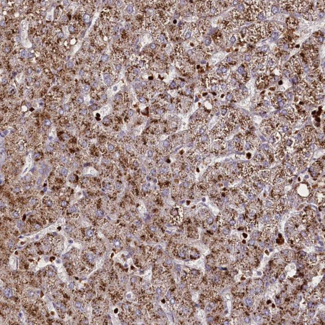 SUSD3 Antibody in Immunohistochemistry (Paraffin) (IHC (P))
