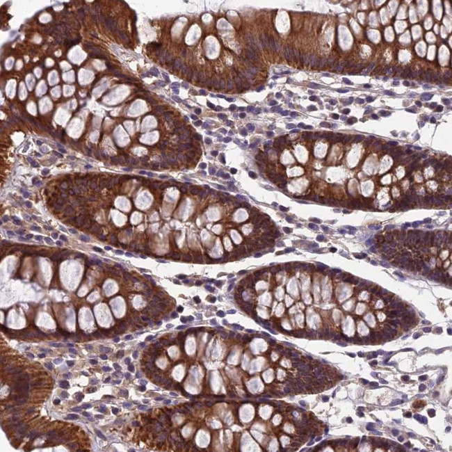 HECA Antibody in Immunohistochemistry (Paraffin) (IHC (P))