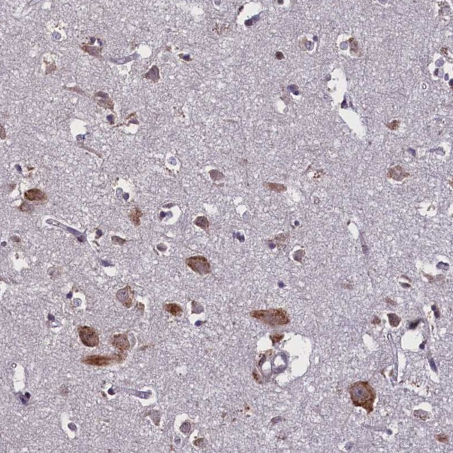 KCNE1L Antibody in Immunohistochemistry (Paraffin) (IHC (P))