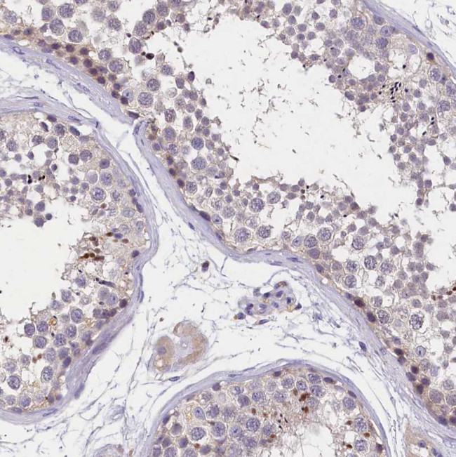 ST7L Antibody in Immunohistochemistry (Paraffin) (IHC (P))