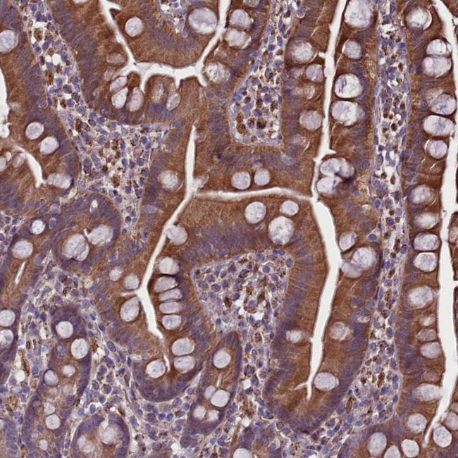 SMCR7 Antibody in Immunohistochemistry (IHC)