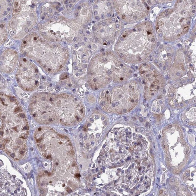 TMEM263 Antibody in Immunohistochemistry (IHC)