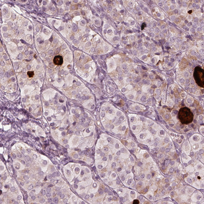 MIA Antibody in Immunohistochemistry (IHC)