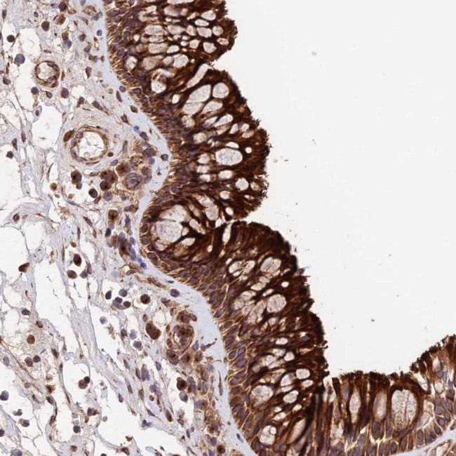 TM111 Antibody in Immunohistochemistry (Paraffin) (IHC (P))