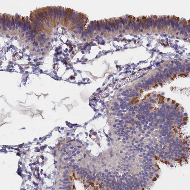 TMEM138 Antibody in Immunohistochemistry (Paraffin) (IHC (P))