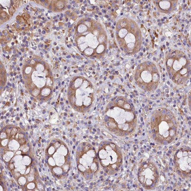 PEMT Antibody in Immunohistochemistry (Paraffin) (IHC (P))