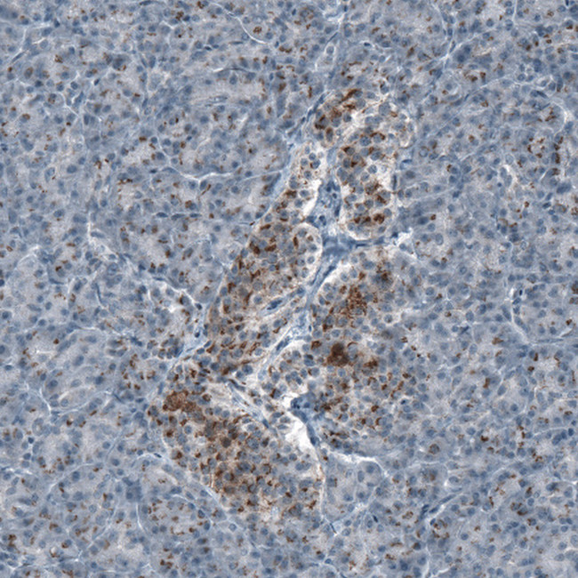 SCD5 Antibody in Immunohistochemistry (Paraffin) (IHC (P))