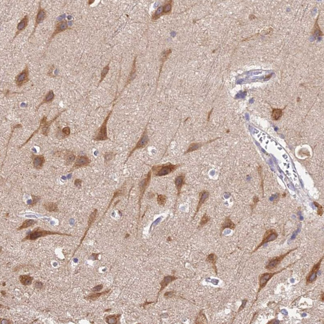 Seipin Antibody in Immunohistochemistry (Paraffin) (IHC (P))
