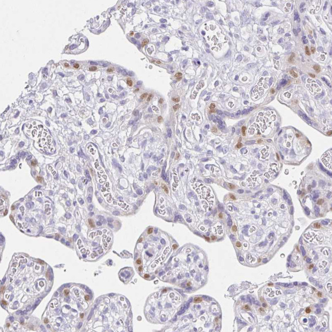 VGLL1 Antibody in Immunohistochemistry (Paraffin) (IHC (P))