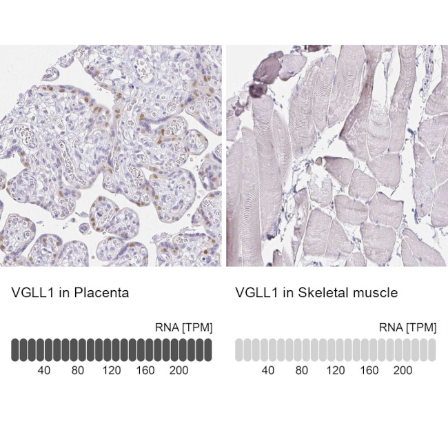 VGLL1 Antibody in Immunohistochemistry (IHC)