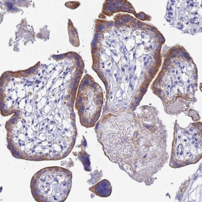 ZNF26 Antibody in Immunohistochemistry (IHC)