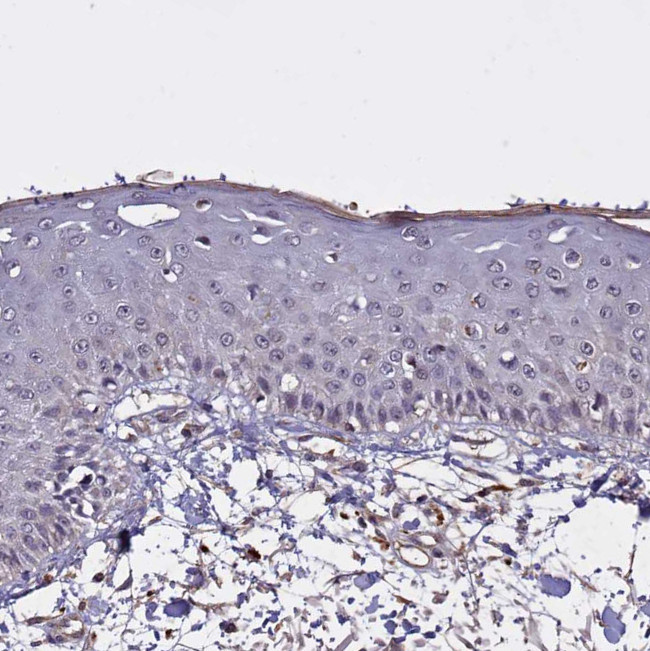 CLRN2 Antibody in Immunohistochemistry (Paraffin) (IHC (P))