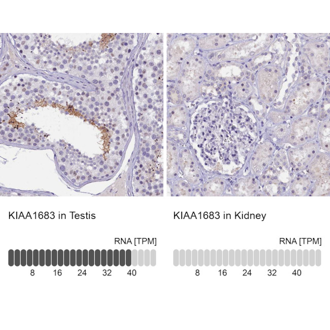 KIAA1683 Antibody in Immunohistochemistry (IHC)