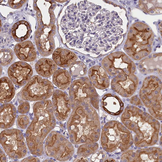 COL19A1 Antibody in Immunohistochemistry (Paraffin) (IHC (P))
