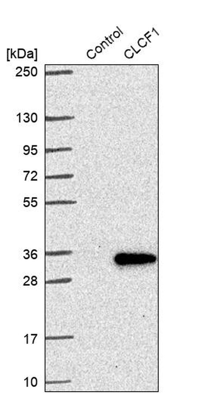 NNT1 Antibody in Western Blot (WB)