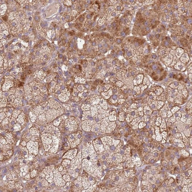 SPATA2L Antibody in Immunohistochemistry (IHC)