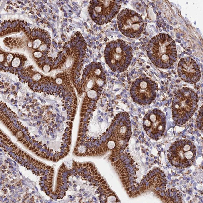 TTC4 Antibody in Immunohistochemistry (Paraffin) (IHC (P))