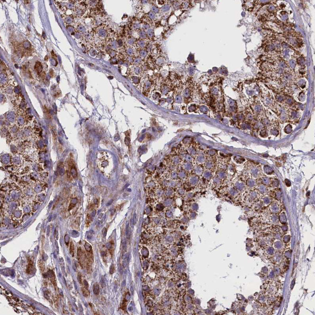 GLRX5 Antibody in Immunohistochemistry (Paraffin) (IHC (P))