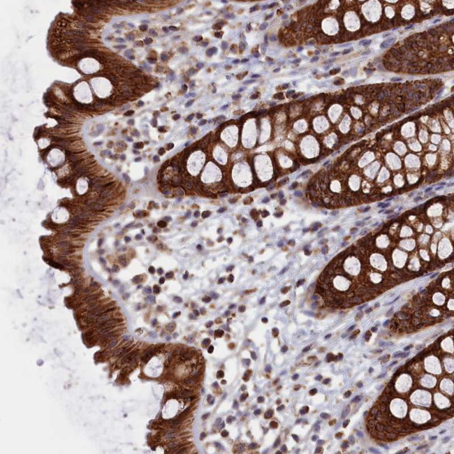 ZNF816 Antibody in Immunohistochemistry (Paraffin) (IHC (P))