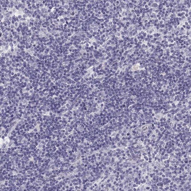 SEMG1 Antibody in Immunohistochemistry (IHC)