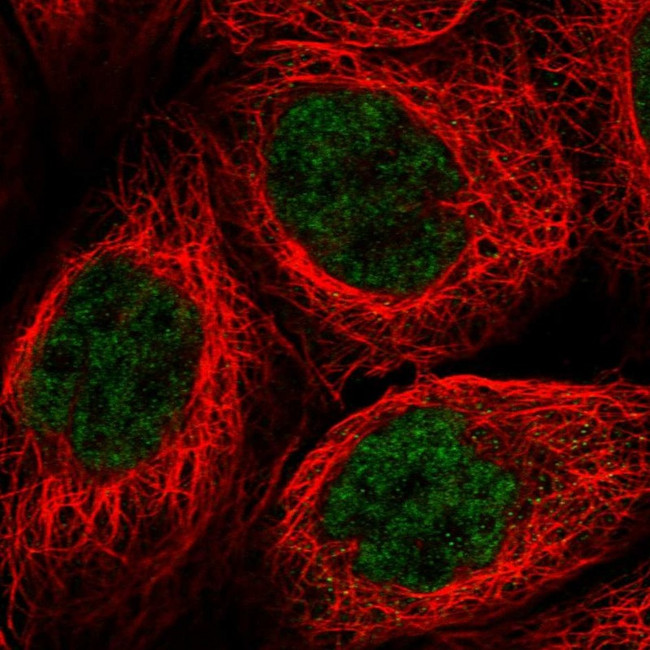 PRELID2 Antibody in Immunocytochemistry (ICC/IF)