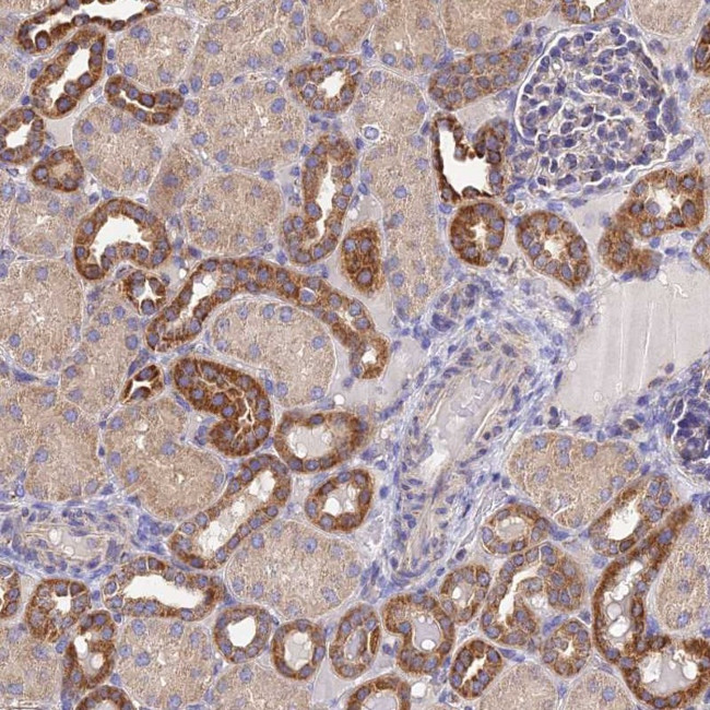 NIPSNAP3A Antibody in Immunohistochemistry (Paraffin) (IHC (P))